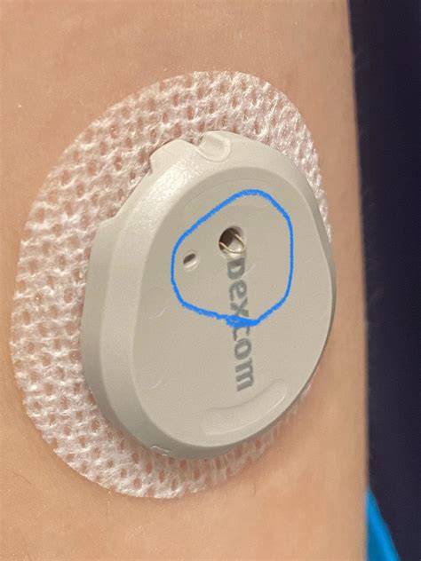 Brief Sensor Issue