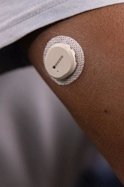 G7 continuous glucose monitor receives FDA clearance nccRea