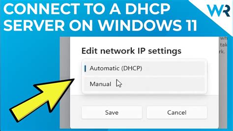 dhcp settings windows 11