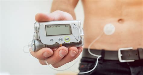 Diabetes Pump Nz