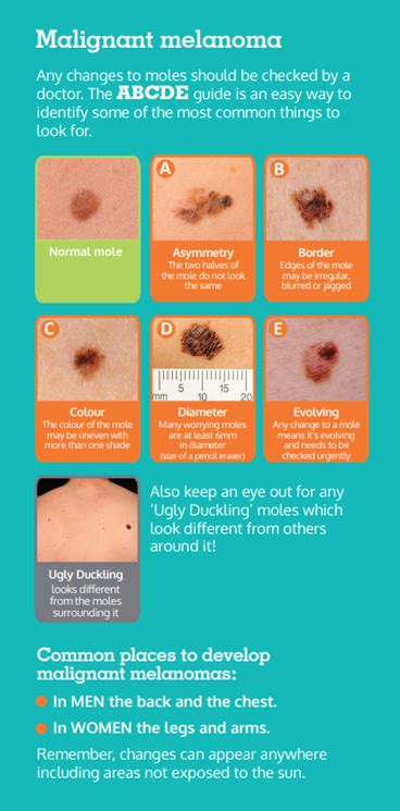 diagnosis melanoma skin cancer