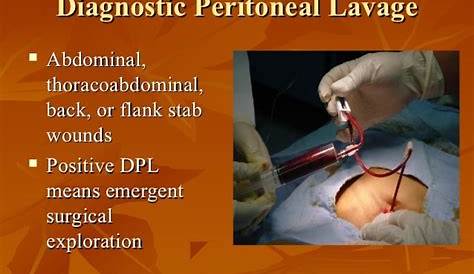 Diagnostic Peritoneal Lavage Ppt PPT ABDOMINAL TRAUMA PowerPoint Presentation, Free