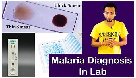 Diagnostic Test For Malaria In India Oscar Medicare Private Limited, New Delhi Manufacturer