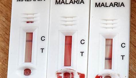 Malaria Rapid Diagnostic Test Strips Photograph by Mauro