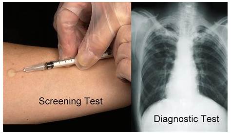 10 x Tuberculosis (TB) Diagnostic Blood Test GP