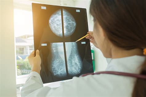 diagnostic mammogram and ultrasound procedure