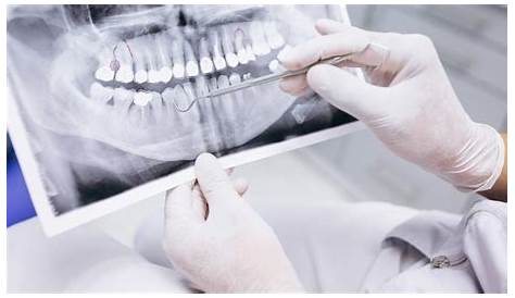 Noticia La importancia de un diágnostico dental correcto