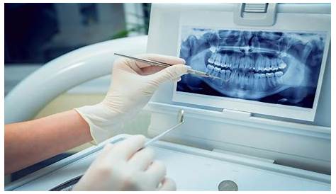 Diagnostico Dental La Importancia Del CBCT (TAC) En El Diagnóstico
