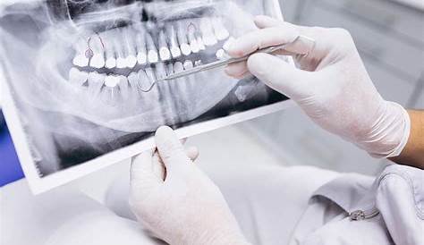 Estudio radiográfico de la caries dental by Alejandro