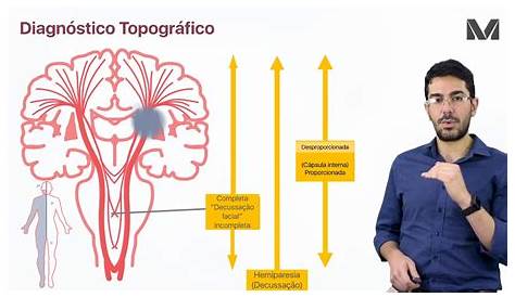 Livro Diagnostico Topografico Em Neurologia Mathias