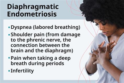 diaphragmatic endometriosis pain location