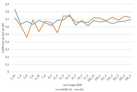 Dice Coefficient Fsl