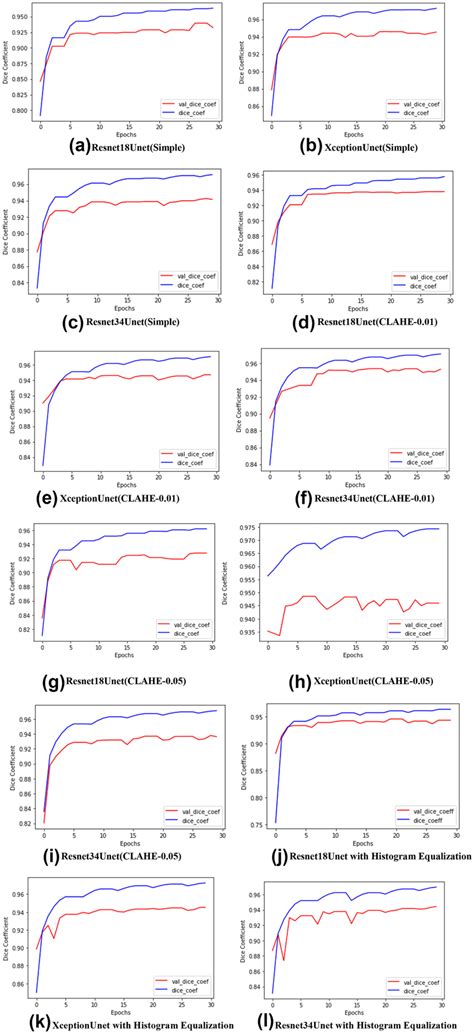 Dice Coefficient Keras