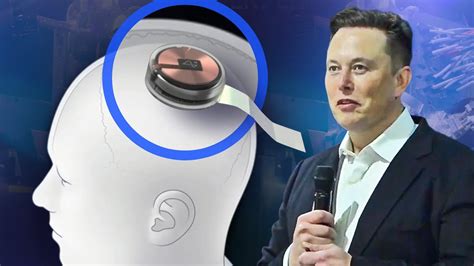 did elon musk invest in neuro tech iq