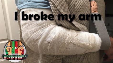 did i break my arm