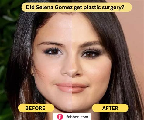 did selena gomez get surgery