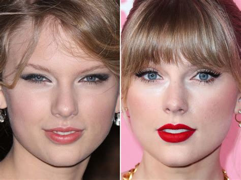 did taylor swift have eye surgery