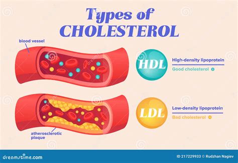 diferencia entre el colesterol hdl y ldl