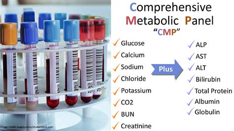 Difference Between Basic And Comprehensive Metabolic Panel