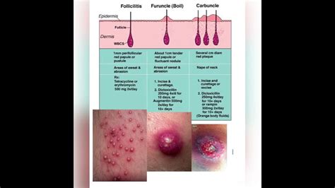 Difference Between Boil And Risen