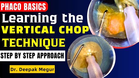 Difference Between Chop And Grind On Food Processor