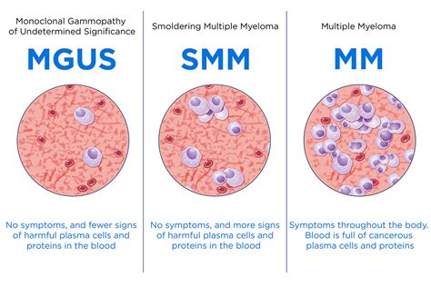 difference between mgus and multiple myeloma