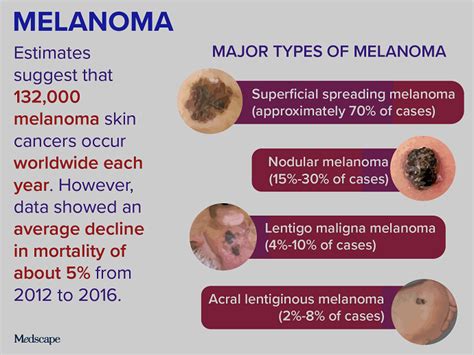 difference between non melanoma and melanoma