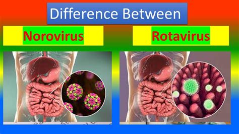 difference between stomach bug and norovirus