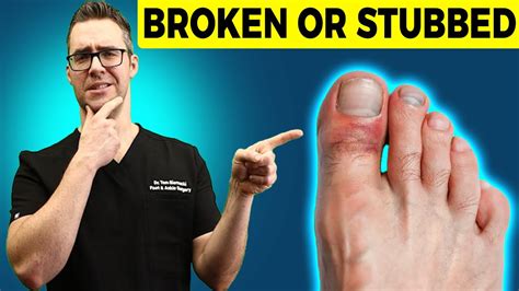 difference between stubbed toe and broken toe