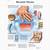 different types of rheumatism