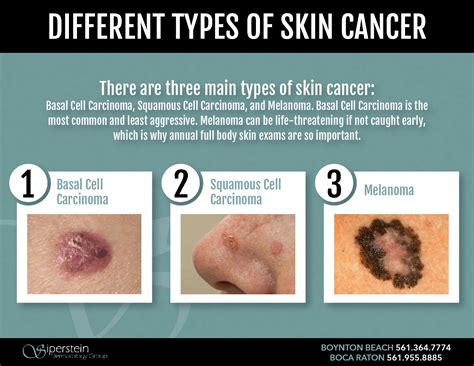 different skin cancers