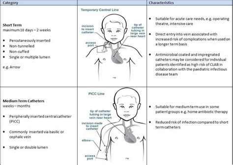 different types of cvcs