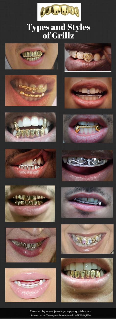 Different Types Of Gold Grillz