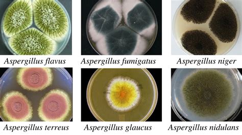 Differential Identification Of Aspergillus Spp