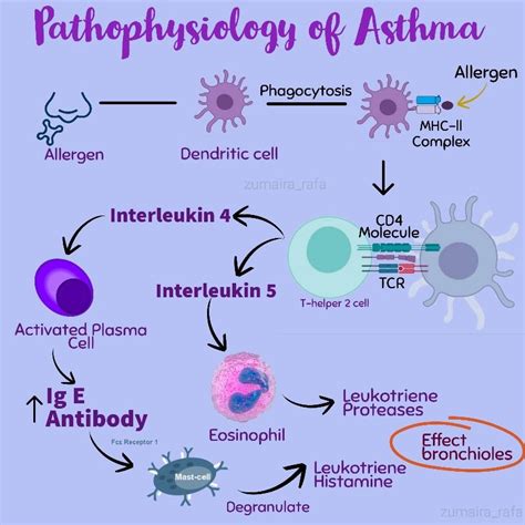 Differentials Asthma