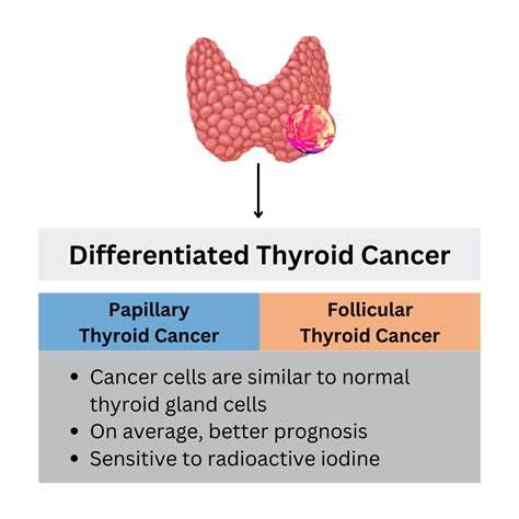 differentiated thyroid cancer types