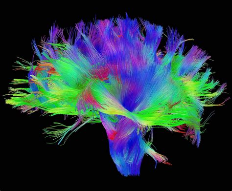 diffusion tensor imaging brain