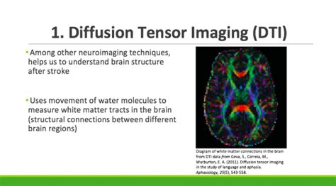 diffusion tensor imaging explained