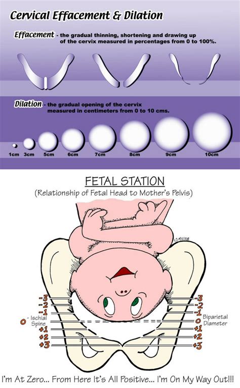 dilation and effacement chart