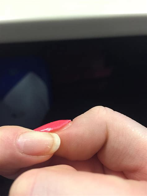 Dip Nails Lifting At Cuticle