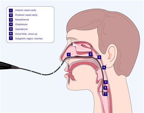Direct Laryngoscopy Ent