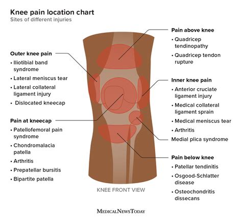 direct trauma to the knee area