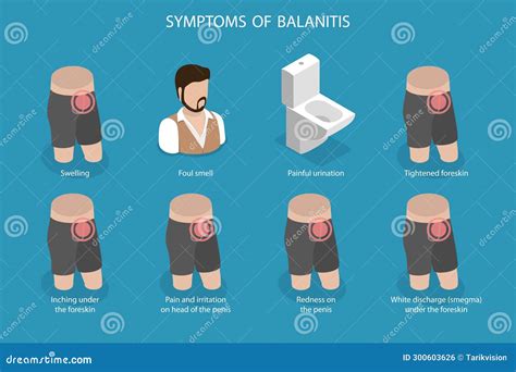 discourse For Balanitis In tike