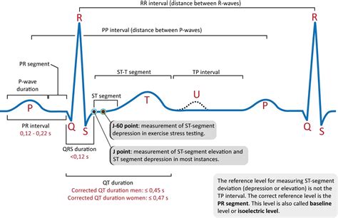 Discuss Ecg Waves Segments And Intervals