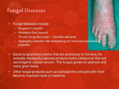 diseases caused by fungi