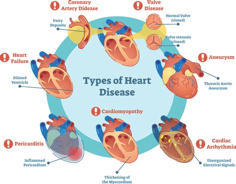 diseases of the heart