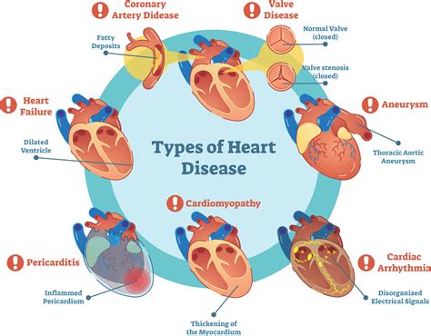 diseases of the heart and blood vessels