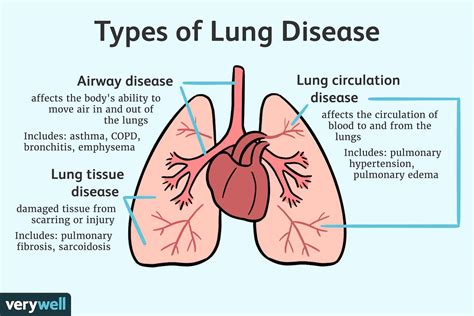 diseases of the lungs