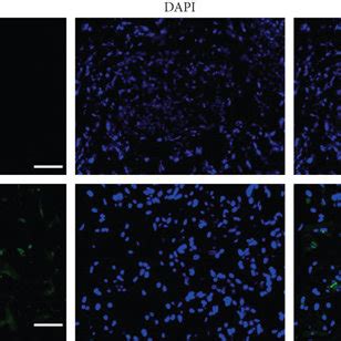 Dithizone Staining Protocol
