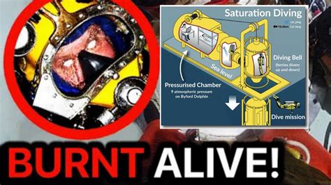 Diving Bell Decompression Accident